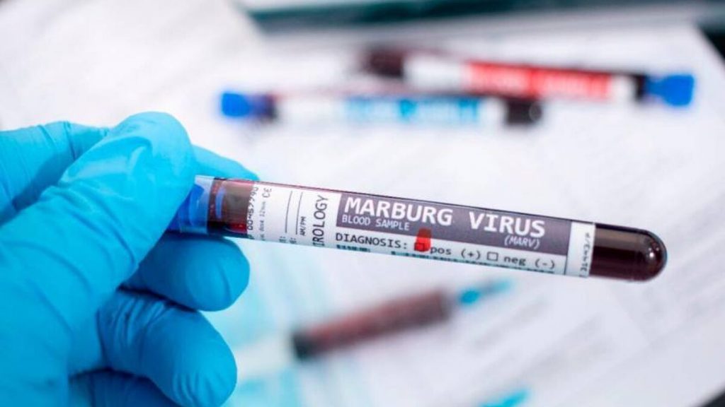Marburg virus, symptoms and routes of infection of the highly contagious disease reactivated in Africa